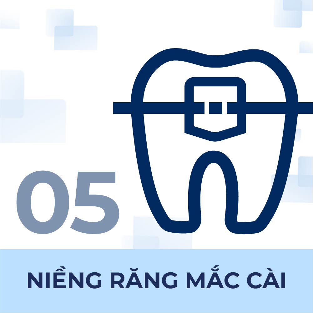 Niềng răng mắc cài chất lượng tại Nha Khoa Quốc Tế SG