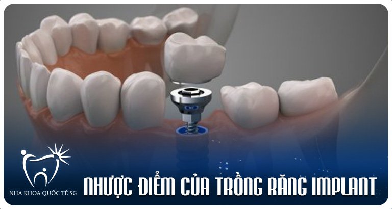 Nha Khoa Quốc Tế Sài Gòn z4974297504425 208e41f91a3311caaff0cac871d1145a