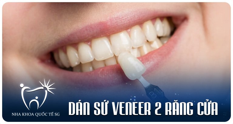 Nha Khoa Quốc Tế Sài Gòn Nha Khoa Quốc Tế Sài Gòn z4974297524131 edd9dec5a3529e09594df2e423412483