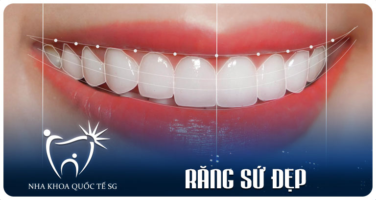 Nha Khoa Quốc Tế Sài Gòn Nha Khoa Quốc Tế Sài Gòn rang su dep