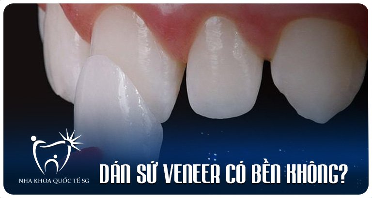 Nha Khoa Quốc Tế Sài Gòn z4974297524129 2e2a95e861c7e798e2a0343e28ff5f72