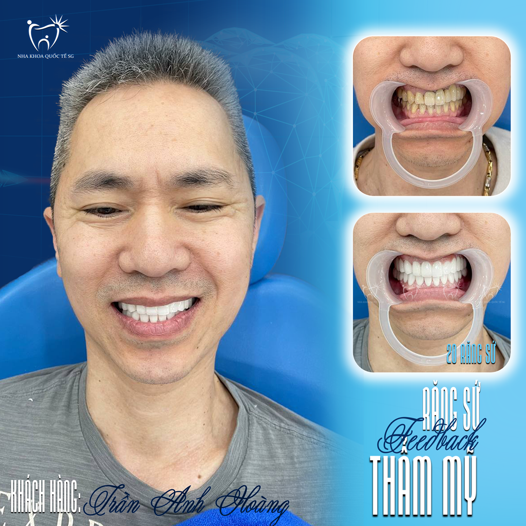 Case Khách Hàng Anh Hoàng