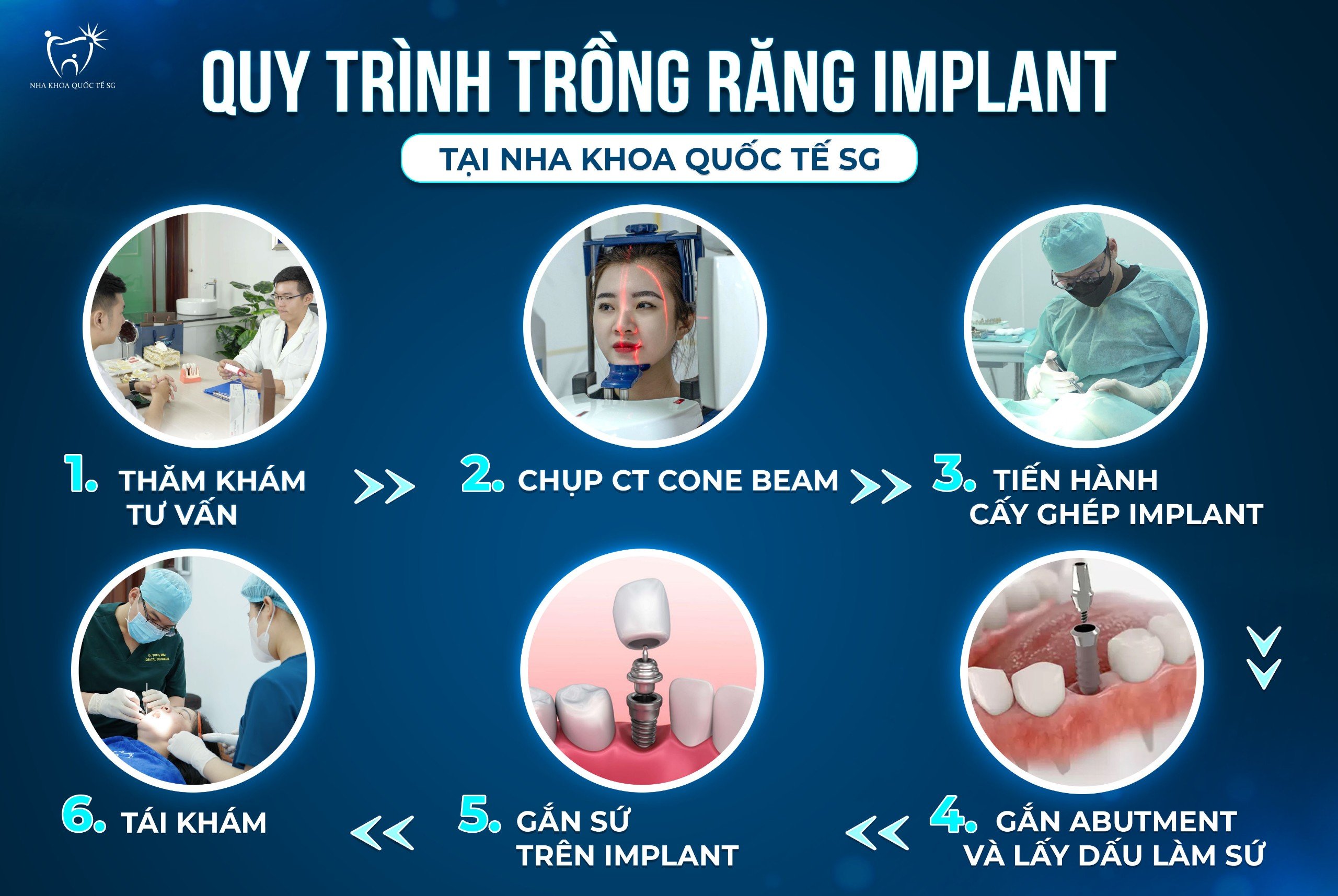 Quy trình tiếp nhận tư vấn cấy ghép Implant tại Nha khoa Quốc Tế SG