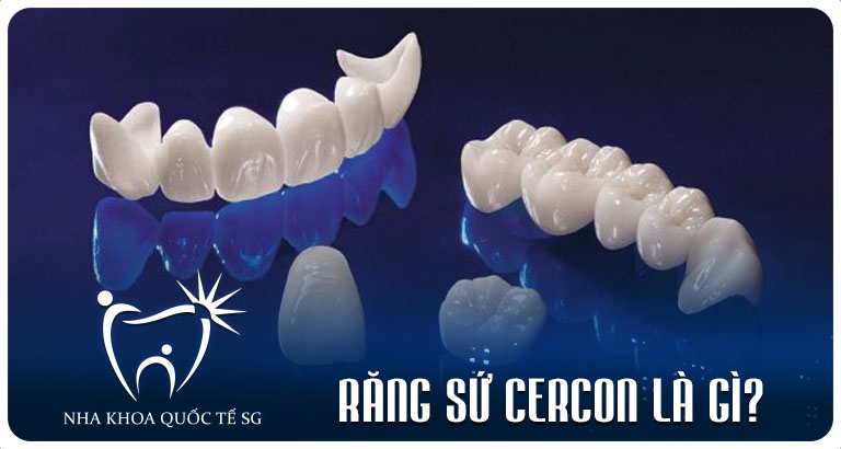 Nha Khoa Quốc Tế Sài Gòn rang su cercon la gi