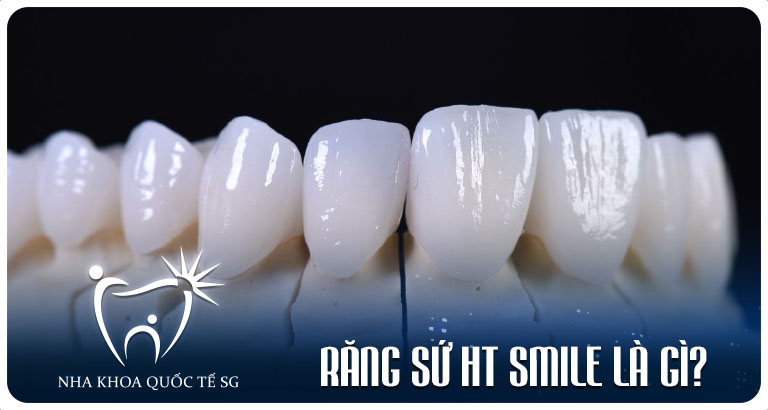 Nha Khoa Quốc Tế Sài Gòn rang su ht smile la gi