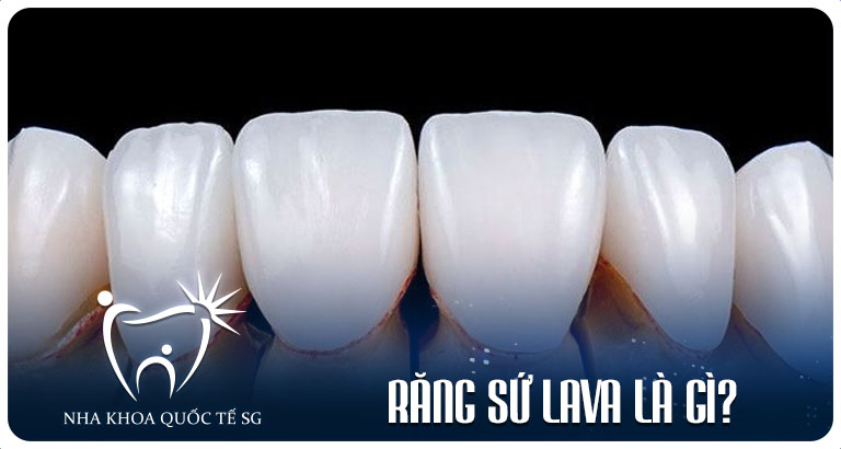 Nha Khoa Quốc Tế Sài Gòn rang su lava la gi