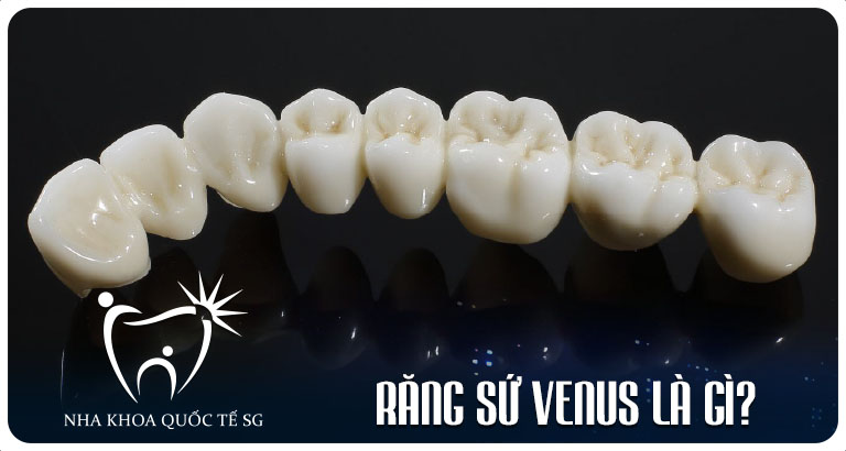 Nha Khoa Quốc Tế Sài Gòn rang su venus la gi