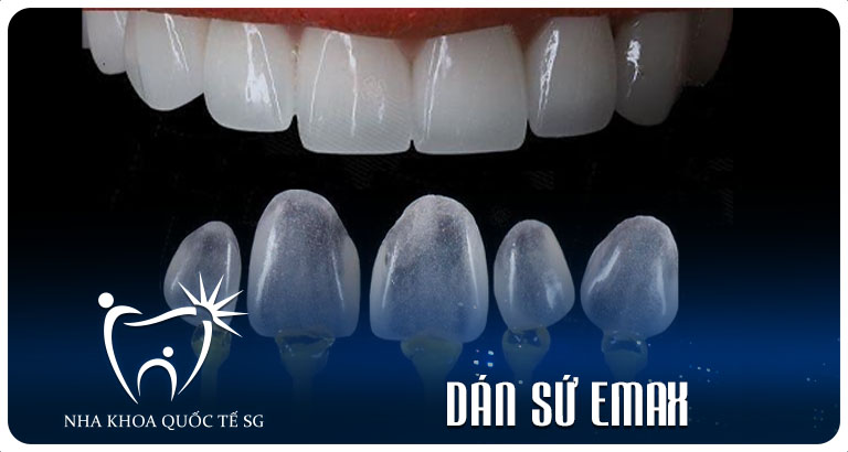 Nha Khoa Quốc Tế Sài Gòn Nha Khoa Quốc Tế Sài Gòn dan su