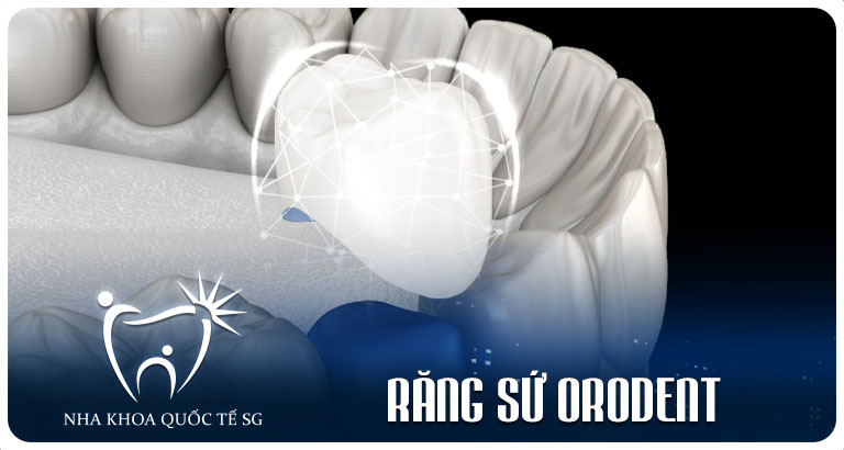 Nha Khoa Quốc Tế Sài Gòn Nha Khoa Quốc Tế Sài Gòn rang su ORODENT