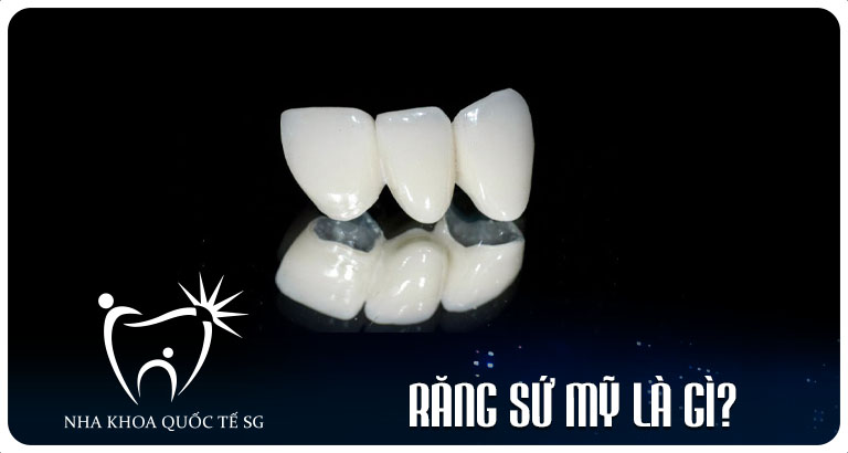 Nha Khoa Quốc Tế Sài Gòn rang su my la gi