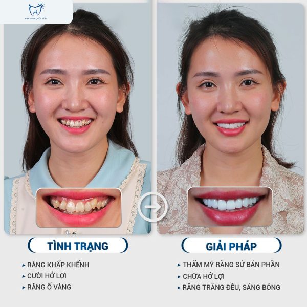 Nha Khoa Quốc Tế Sài Gòn Nha Khoa Quốc Tế Sài Gòn 448622014 122165536232087528 6046794391779886906 n