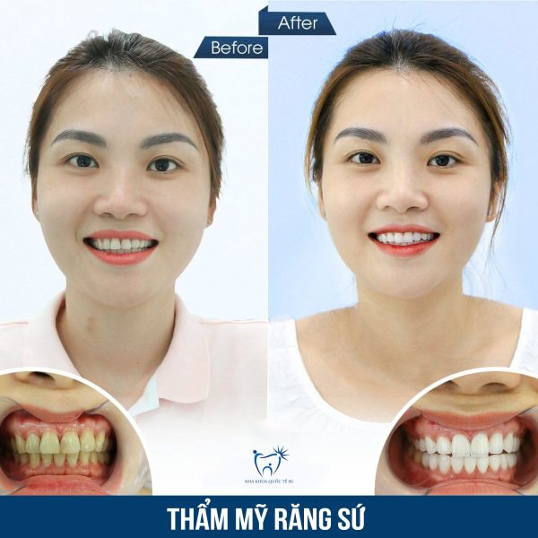 Nha Khoa Quốc Tế Sài Gòn Nha Khoa Quốc Tế Sài Gòn 449653386 122168125514087528 6982419553857373634 n