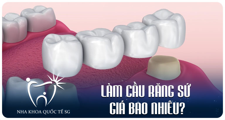 Nha Khoa Quốc Tế Sài Gòn Nha Khoa Quốc Tế Sài Gòn Lam cau rang su gia bao nhieu 1