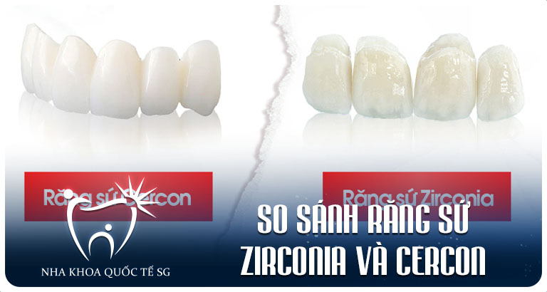 Nha Khoa Quốc Tế Sài Gòn Nha Khoa Quốc Tế Sài Gòn So sanh rang su zirconia va cercon 1