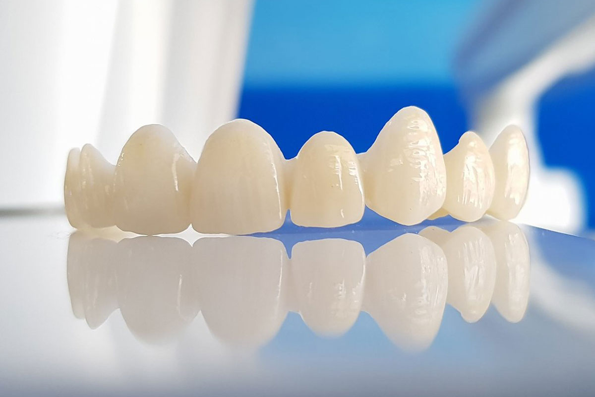 Đặc điểm răng sứ Zirconia