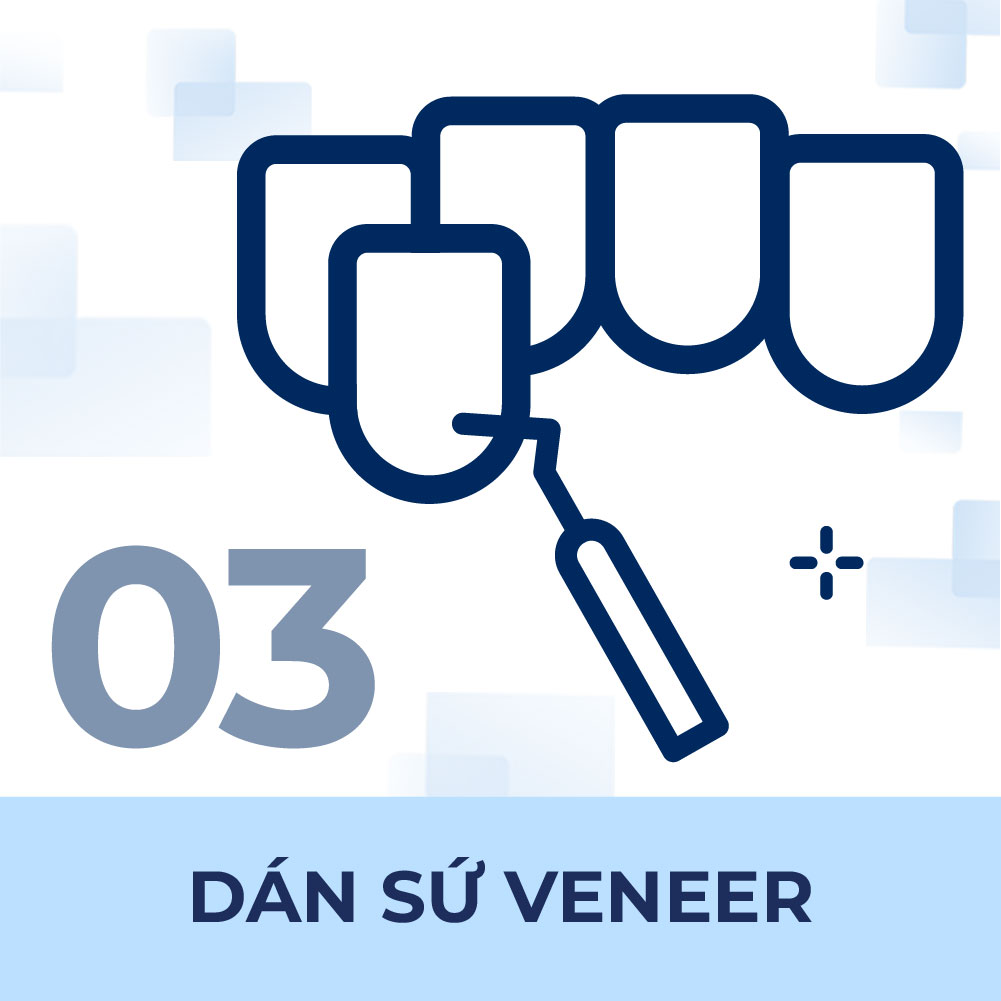 Dán sứ veneer chất lượng tại TP.HCM