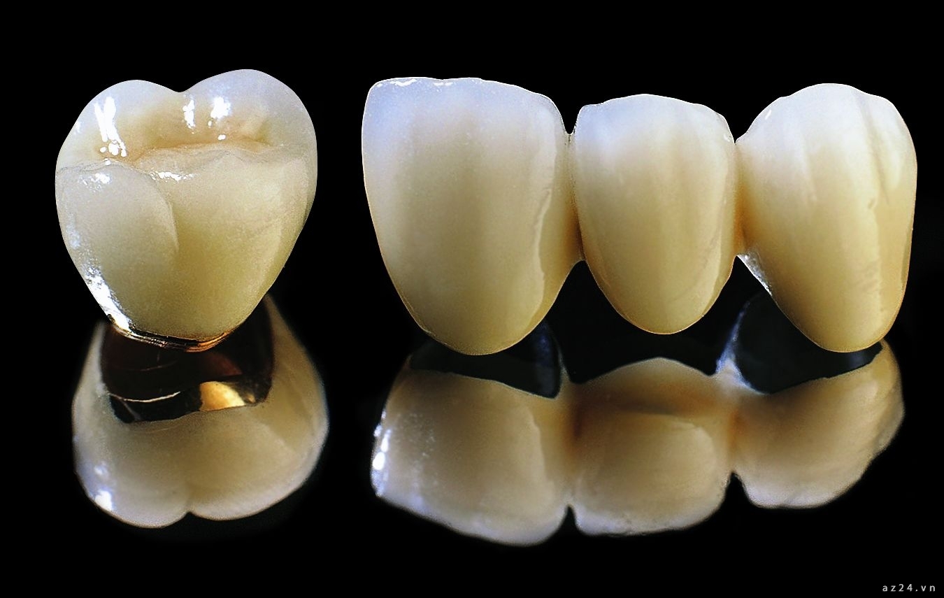 Nha Khoa Quốc Tế Sài Gòn Dễ xảy ra tình trạng đen viền nướu