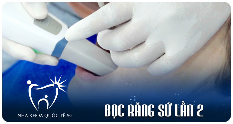 Nha Khoa Quốc Tế Sài Gòn Nha Khoa Quốc Tế Sài Gòn boc rang su lan 2