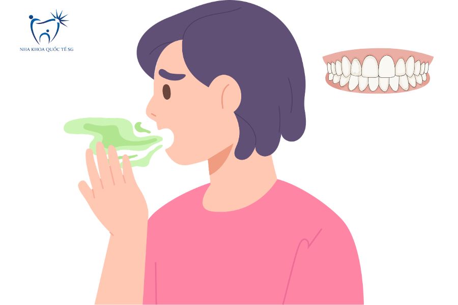 Nha Khoa Quốc Tế Sài Gòn Bọc răng sứ xong bị hôi miệng