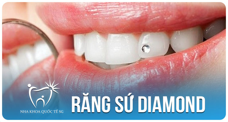 Nha Khoa Quốc Tế Sài Gòn Nha Khoa Quốc Tế Sài Gòn rang su diamond