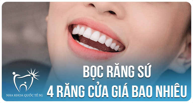 Nha Khoa Quốc Tế Sài Gòn boc rang su 4 rang cua gia bao nhieu 1