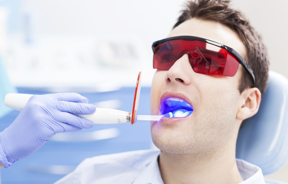 Nha Khoa Quốc Tế Sài Gòn Quy trình tẩy trắng răng tại Nha khoa Quốc tế SG