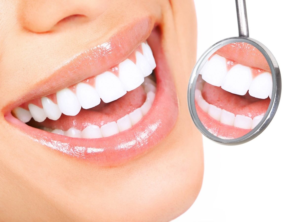 Nha Khoa Quốc Tế Sài Gòn Tẩy trắng răng tại nhà hay phòng khám?