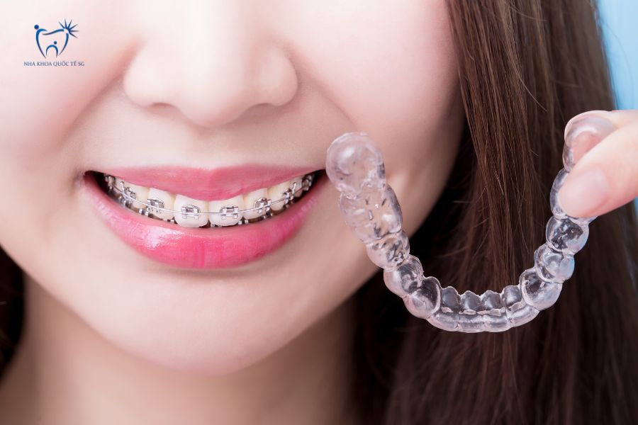 Nha Khoa Quốc Tế Sài Gòn Niềng răng mắc cài và niềng trong suốt Invisalign
