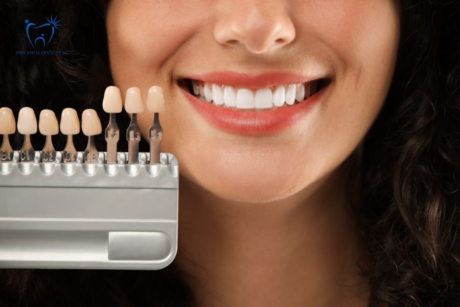 Bảng màu răng sứ giúp khách hàng lựa chọn màu sắc răng phù hợp