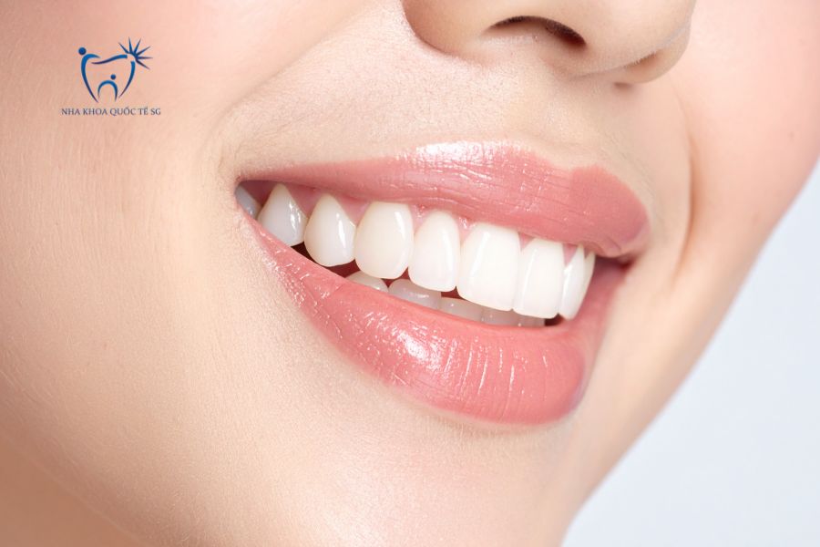 Nha Khoa Quốc Tế Sài Gòn Khách hàng sau khi làm răng sứ