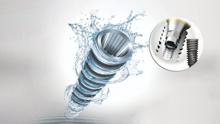 Trụ Osstem Implant xuất xứ Hàn Quốc
