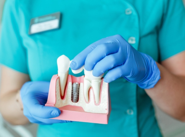 Nha Khoa Quốc Tế Sài Gòn Địa chỉ trồng răng Implant tốt nhất tại Hà Nội