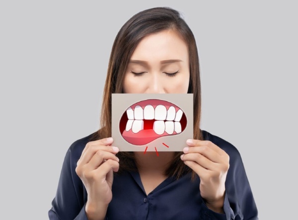 Nha Khoa Quốc Tế Sài Gòn Chi phí điều trị có thể gấp đôi, gấp ba lần so với trồng implant sớm