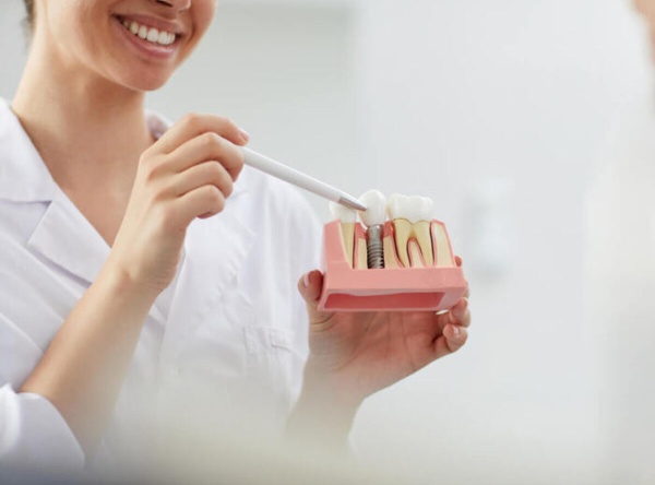 Nha Khoa Quốc Tế Sài Gòn Trồng răng Implant có nhiều ưu điểm vượt trội so với các phương pháp khác