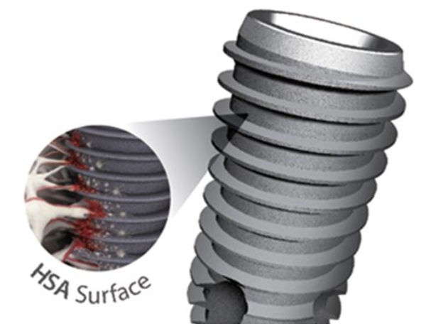 Nha Khoa Quốc Tế Sài Gòn Trụ Implant Dio có hình dạng thẳng, với vòng xoắn đều đặn kéo dài từ đáy đến đỉnh
