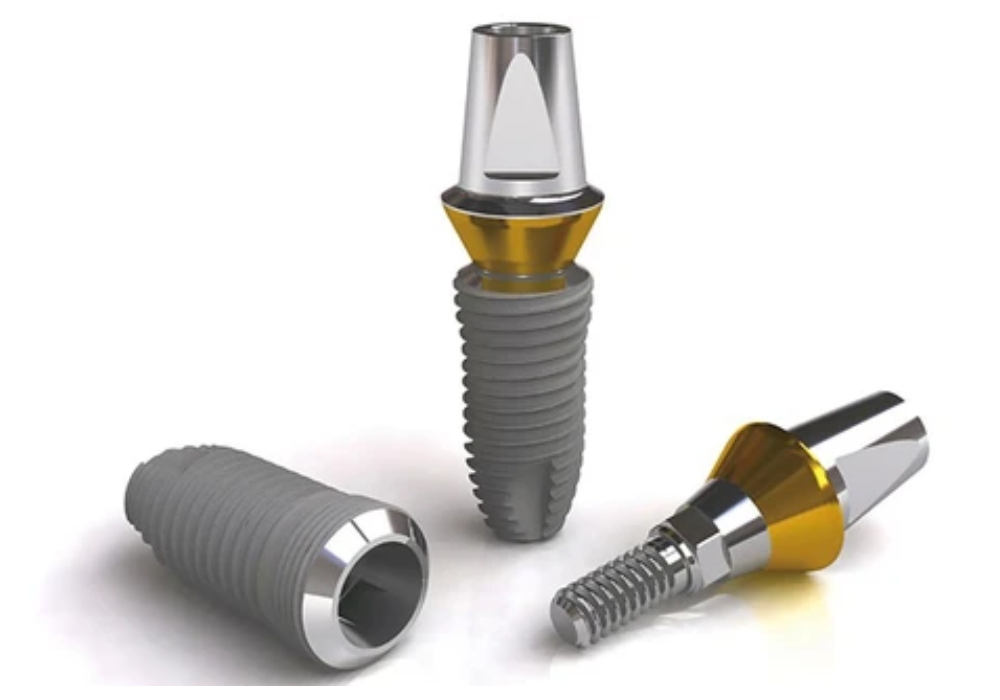 Nha Khoa Quốc Tế Sài Gòn Implant của Pháp ETK Active