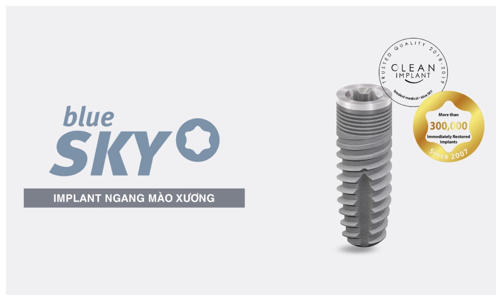 Nha Khoa Quốc Tế Sài Gòn Implant SKY Implant System được phát triển và sản xuất bởi tập đoàn bredent medical của Đức