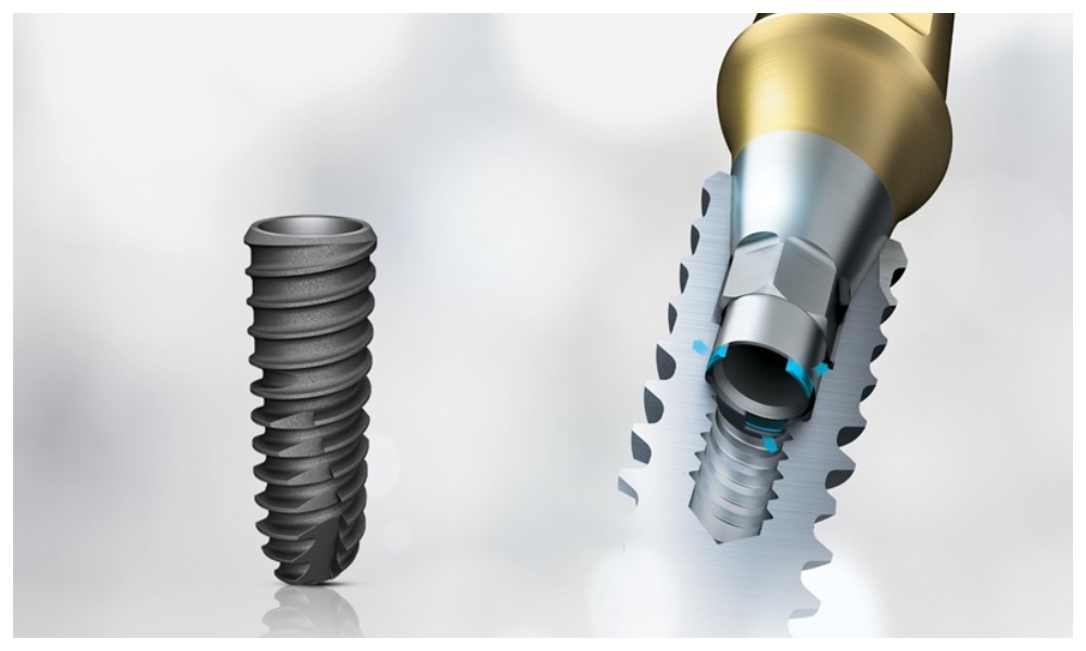 Nha Khoa Quốc Tế Sài Gòn Implant Osstem được làm từ vật liệu Titanium tinh khiết 100%, an toàn sinh học