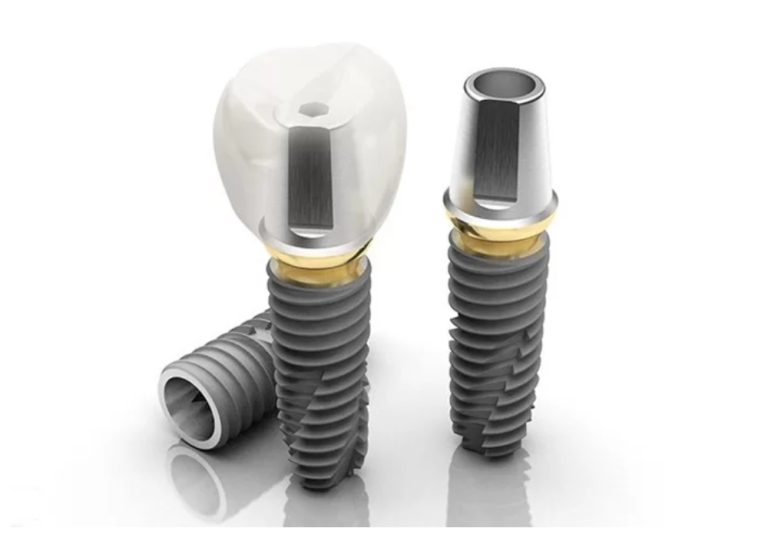 Implant Đức đều được kiểm định chất lượng nghiêm ngặt theo tiêu chuẩn Châu Âu