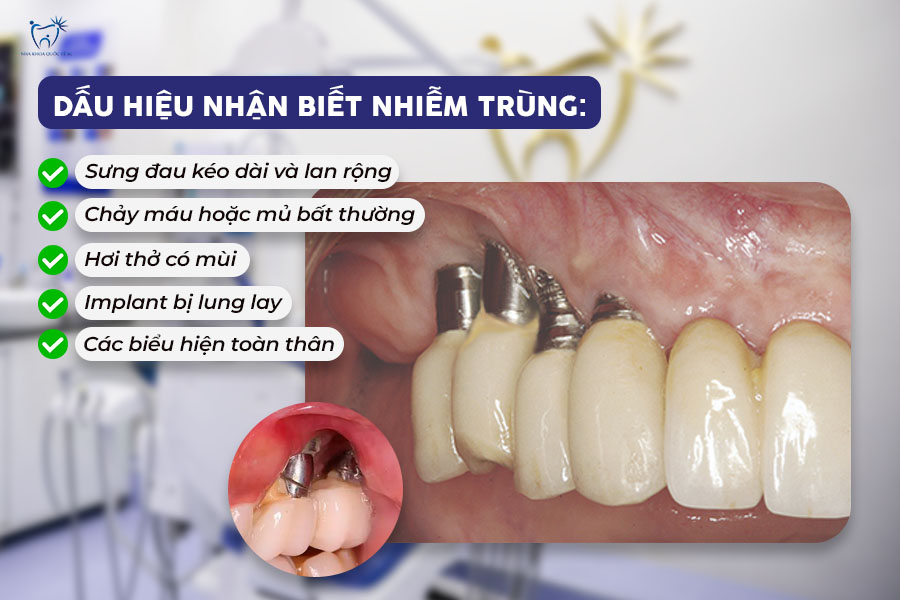 Nha Khoa Quốc Tế Sài Gòn Các dấu hiệu thường gặp khi bị nhiễm trùng implant