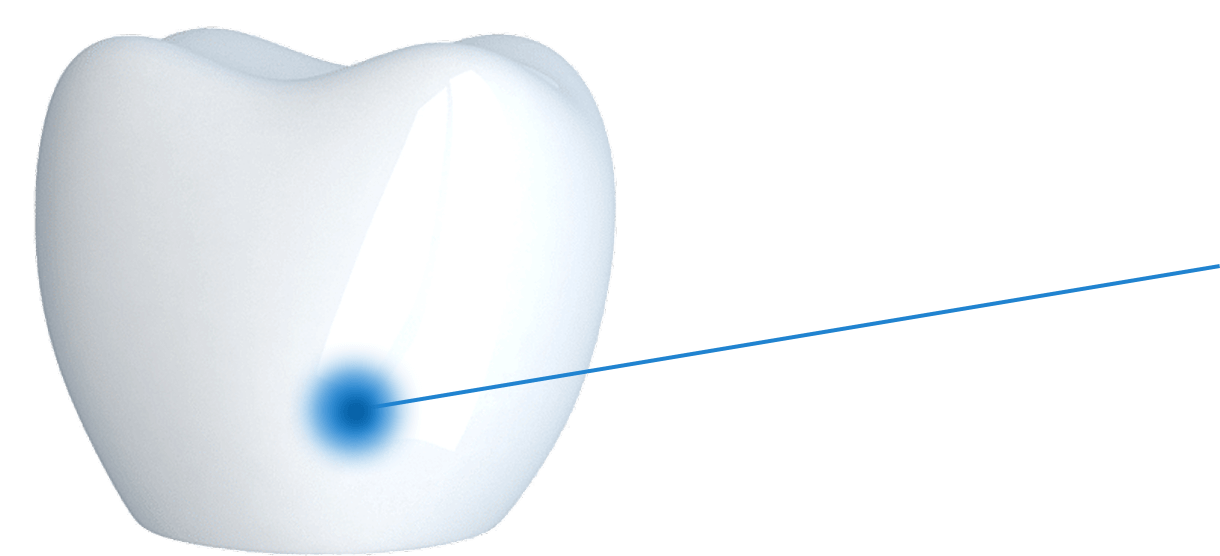 [Mobile] Cấu tạo răng implant 1