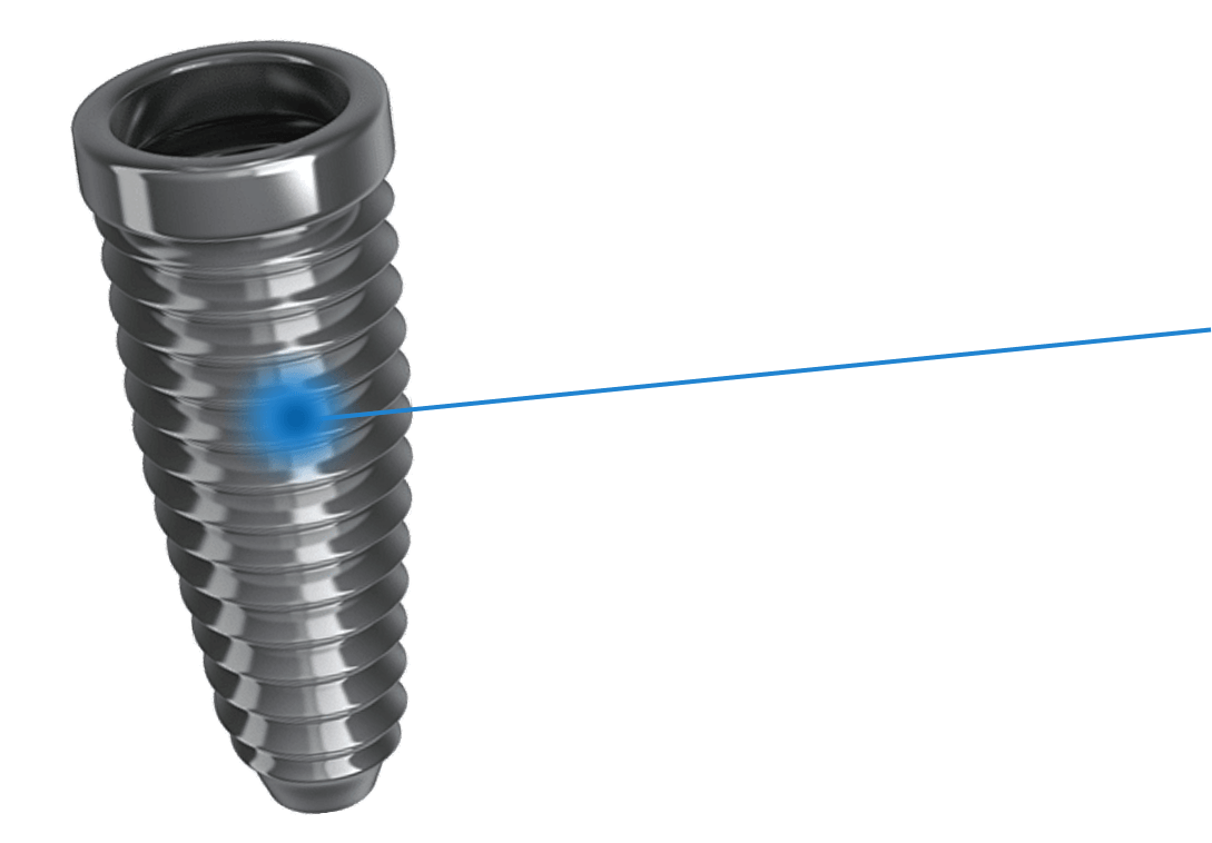 Trụ Implant - mobile