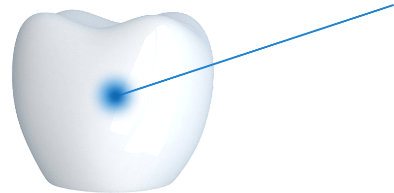 [Desktop] Cấu tạo răng implant 1