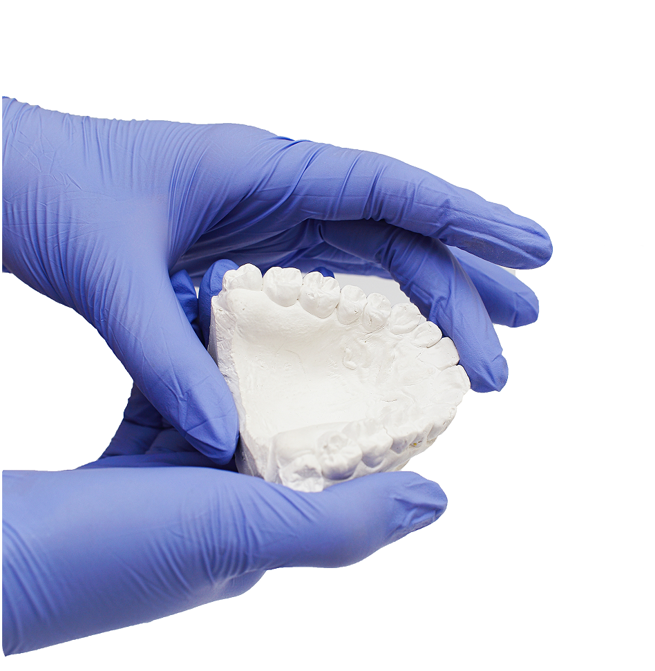 Lấy dấu răng và chế tạo mão răng sứ