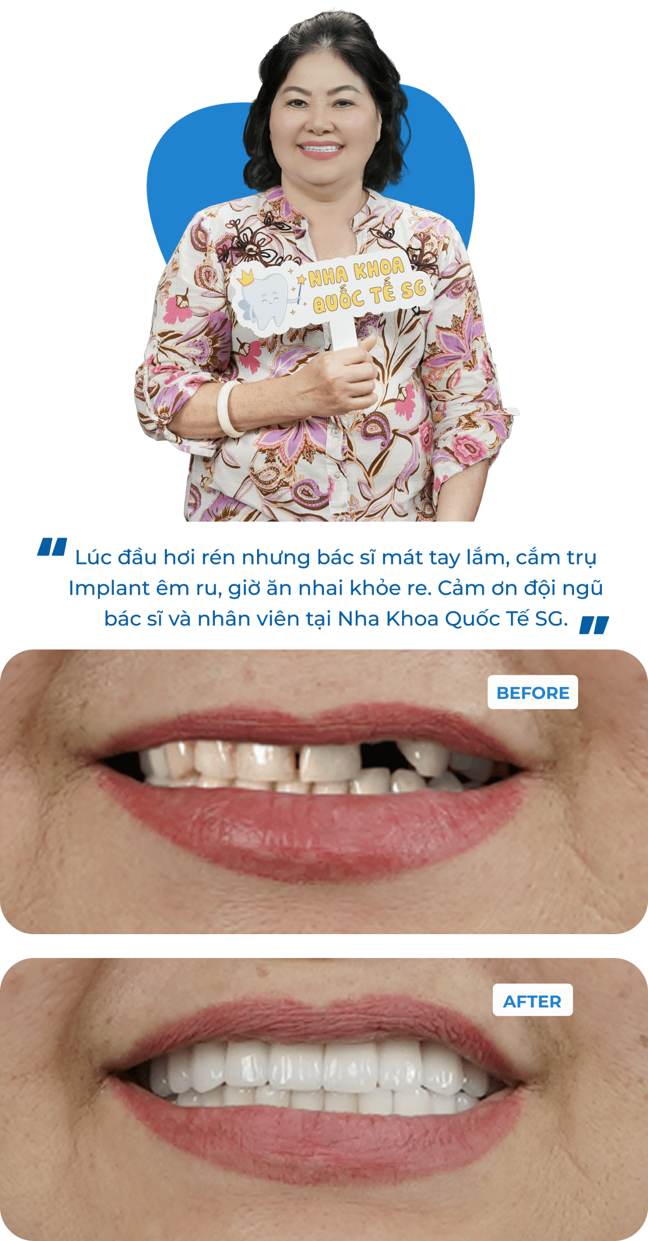 Dental Implant Case 3