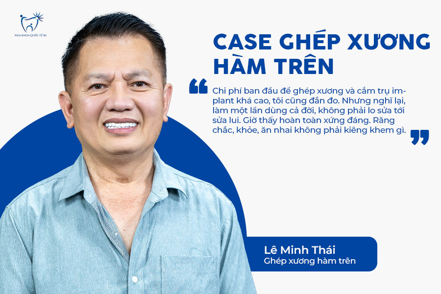 Nha Khoa Quốc Tế Sài Gòn Trải nghiệm thực tế của Anh Thái khi ghép xương để trồng Implant