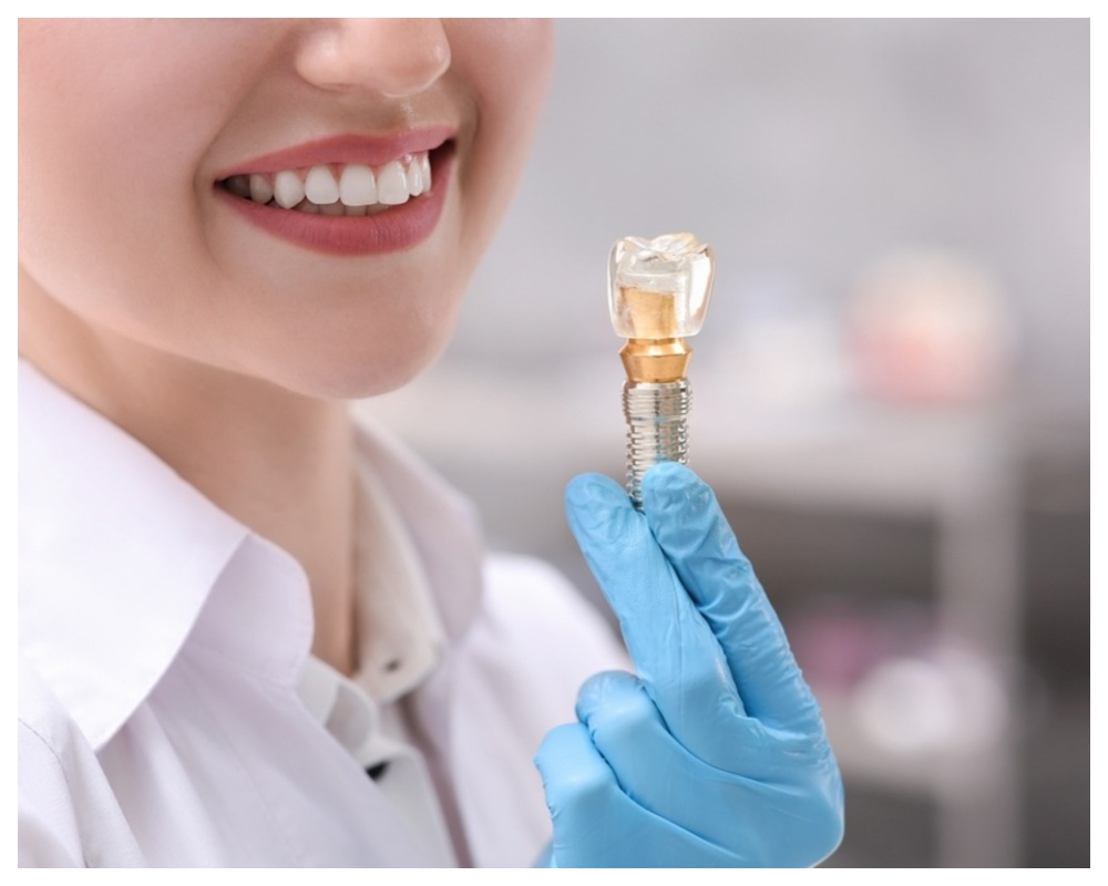 Nha Khoa Quốc Tế Sài Gòn Tác hại tiềm ẩn bạn cần biết của việc cấy ghép Implant