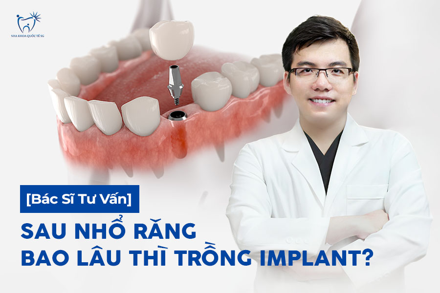 Nha Khoa Quốc Tế Sài Gòn Bác sĩ tư vấn các mốc thời gian trồng Implant sau nhổ răng