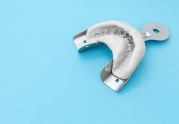 Nha Khoa Quốc Tế Sài Gòn Lấy dấu khay mở Implant mang lại độ chính xác cao và giảm lệch khớp cắn