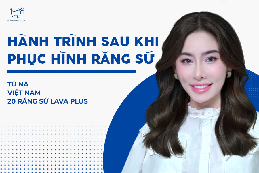 hành trình phục hình răng sứ của khách hàng Tú Na